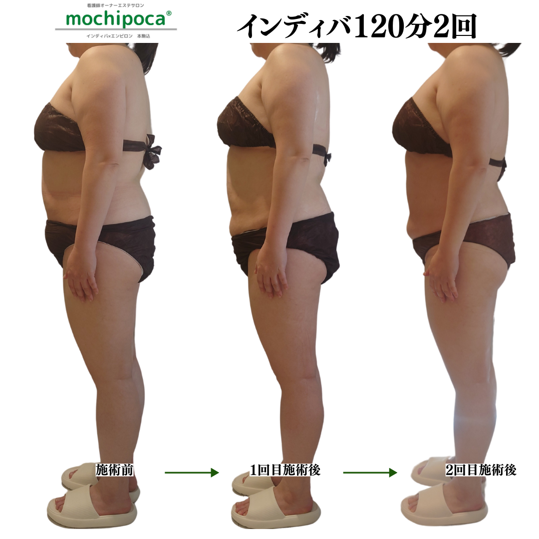 インディバたったの2回